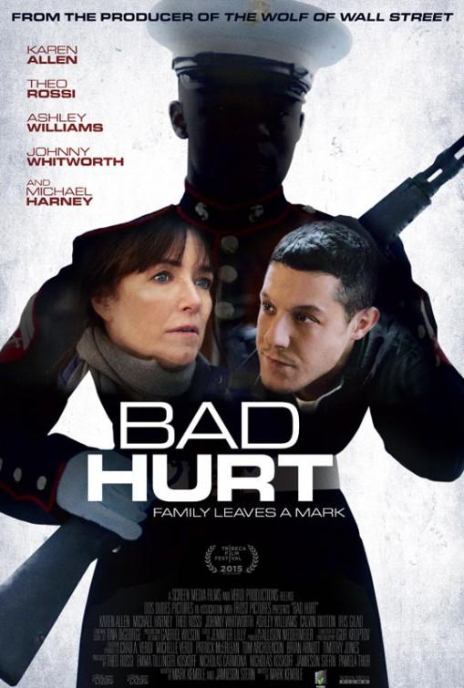 Bad Hurt  (2014)